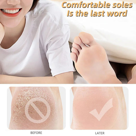 Silicone Heel Protectors – Moisturizing, Anti-Crack & Callus Care Socks