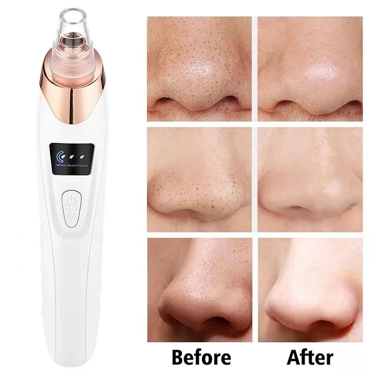 Electric Blackhead Remover – Pore Vacuum Cleaner with 5 Probes