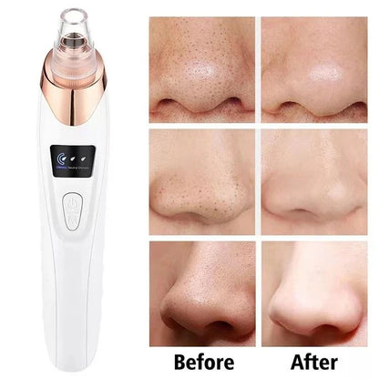 Electric Blackhead Remover – Pore Vacuum Cleaner with 5 Probes